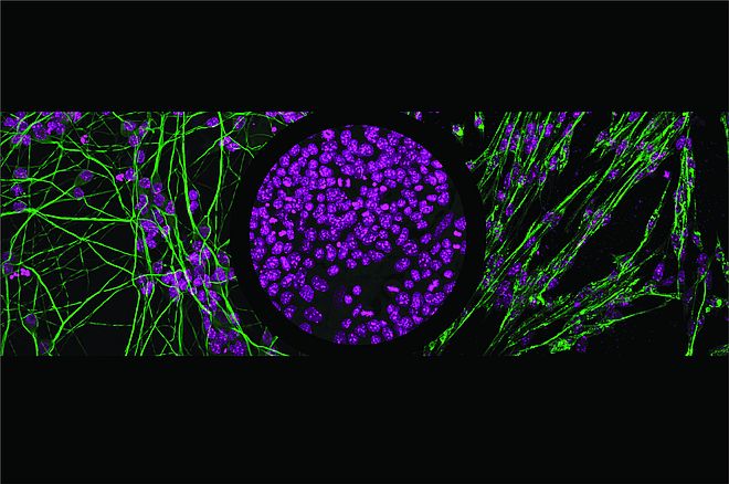Patterns in transcription factor binding help predict whether undifferentiated cells