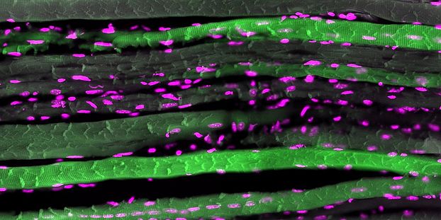 Sections of multinucleated muscle fibers (green; nuclei in magenta).