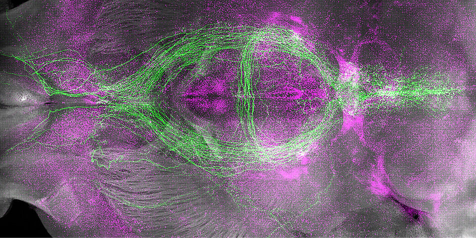 Sleep-promoting neurons (green) and recently activated neurons (magenta) in the mouse brain.