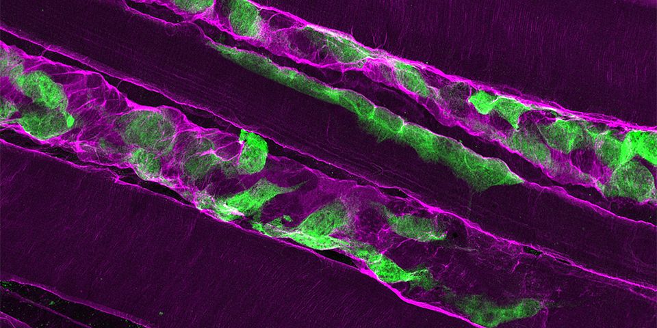 After a muscle injury, muscle stem cells (green) secrete laminin-α2 (magenta) into their surroundings to support their proliferation.