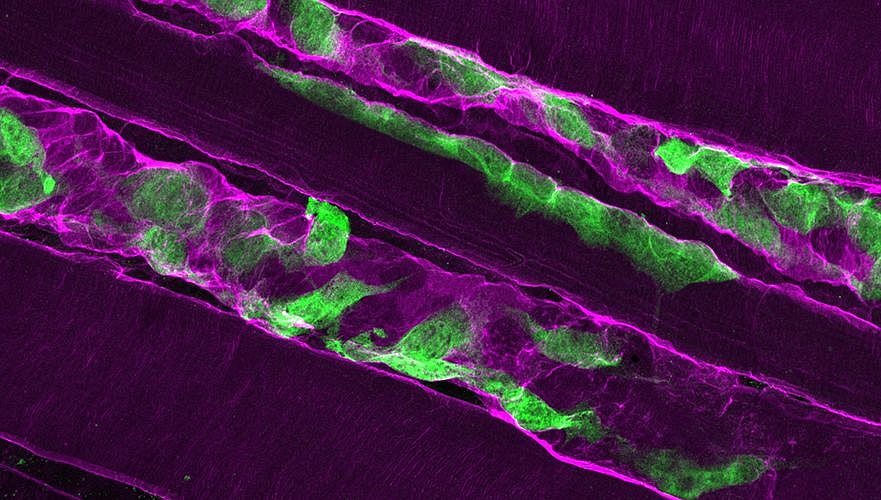 After a muscle injury, muscle stem cells (green) secrete laminin-α2 (magenta) into their surroundings to support their proliferation.