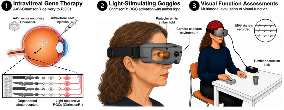 Optogenetic therapy shows safe step forward in vision restoration