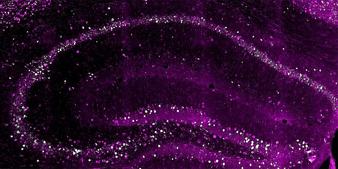 Early-born neurons 