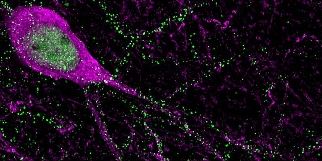 Inhibitory neurons (magenta) and their synapses (green) in the mouse neocortex.