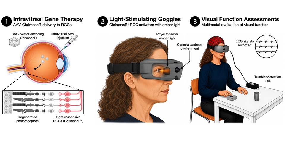 Optogenetic therapy shows safe step forward in vision restoration